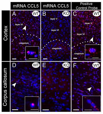 Glial- and Neuronal-Specific Expression of CCL5 mRNA in the Rat Brain